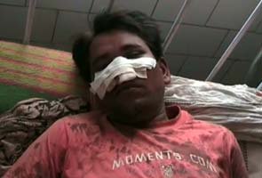 Dalit nose chopped off by uppercastes for riding motorcycle bhopal